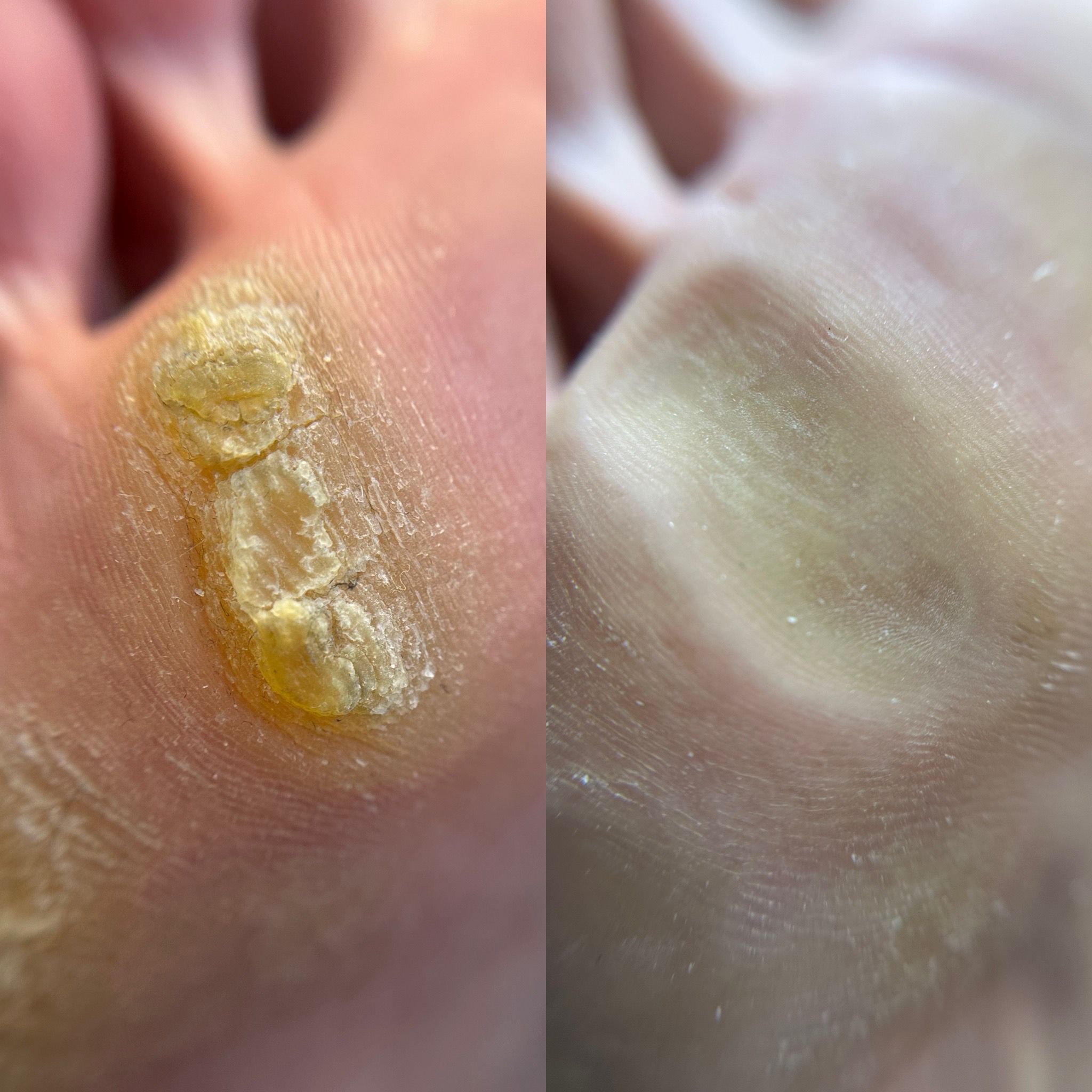 Curs de Pedichiură Complexă